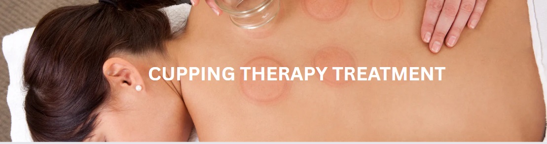 Cupping therapy treatment Stirling